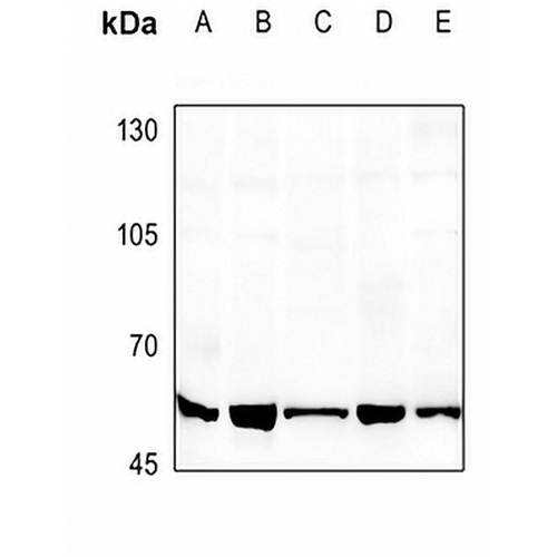 ATF2 Rabbit Polyclonal Antibody