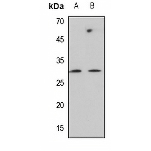 C-Reactive Protein Rabbit Polyclonal Antibody