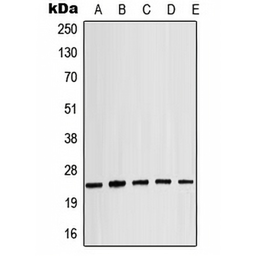 Alpha-crystallin B (Phospho-S19) Rabbit Polyclonal Antibody