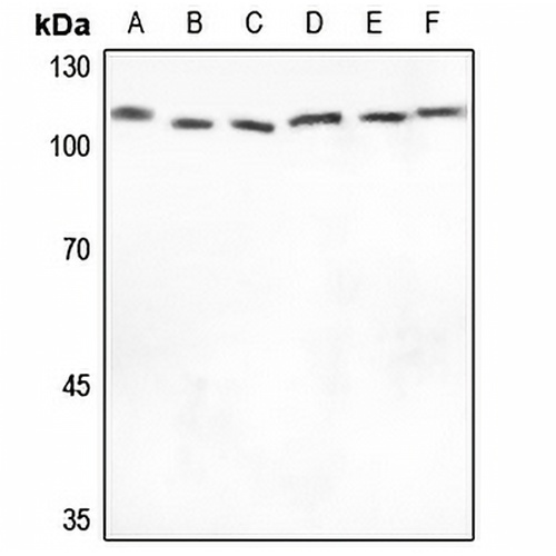 XPO2 Rabbit Polyclonal Antibody