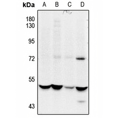 CSK (Phospho-S364) Rabbit Polyclonal Antibody