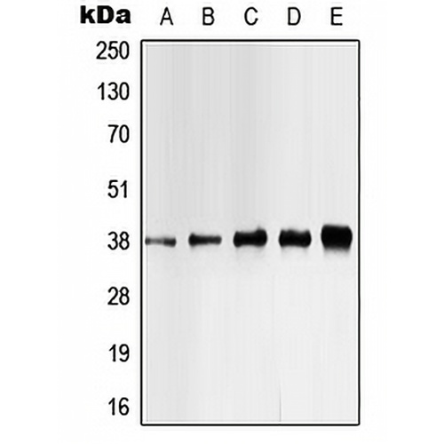 CK1 alpha (Phospho-Y321) Rabbit Polyclonal Antibody