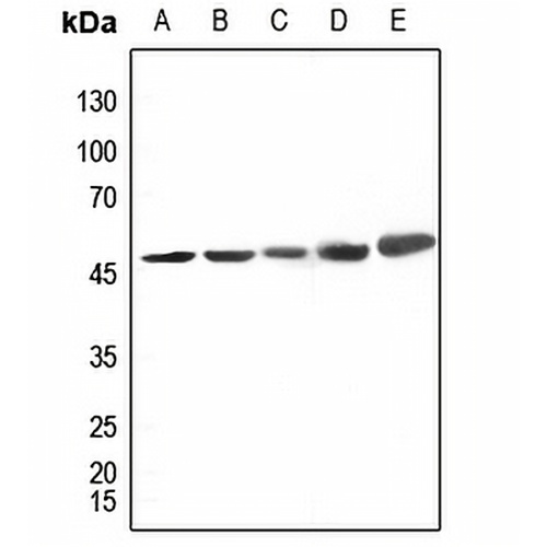 CK1 delta Rabbit Polyclonal Antibody