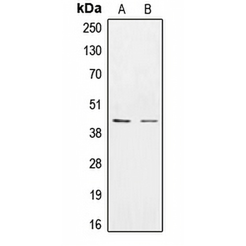 CK1 epsilon Rabbit Polyclonal Antibody