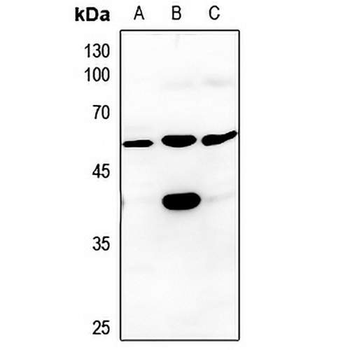 CK1 gamma 3 Rabbit Polyclonal Antibody