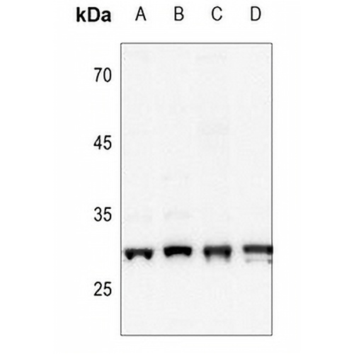 CK2 beta (Phospho-S209) Rabbit Polyclonal Antibody