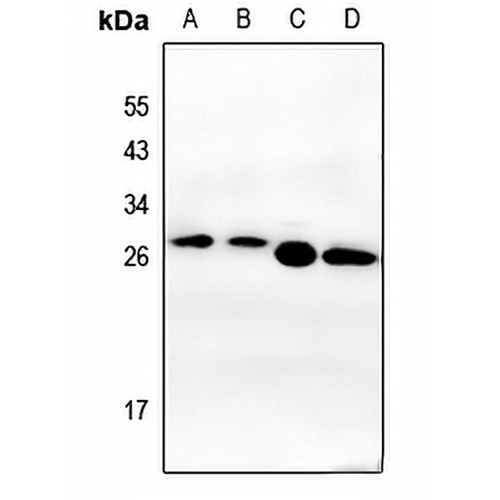 CK2 beta Rabbit Polyclonal Antibody