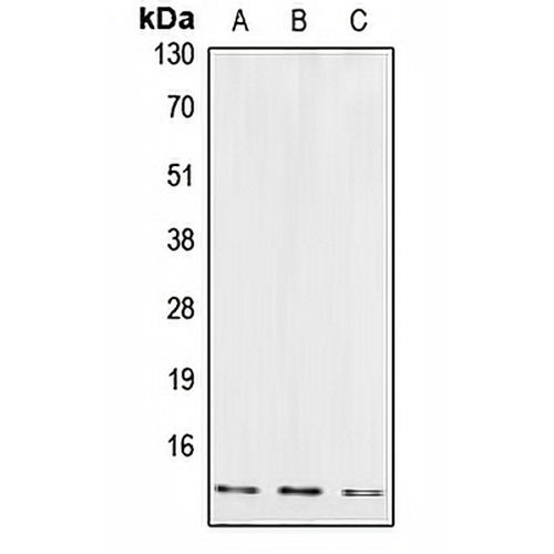 Cystatin B Rabbit Polyclonal Antibody
