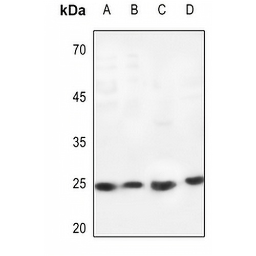 Cardiotrophin-1 Rabbit Polyclonal Antibody