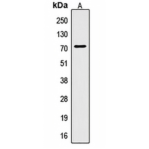 CTPS Rabbit Polyclonal Antibody