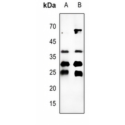 Cathepsin B Rabbit Polyclonal Antibody