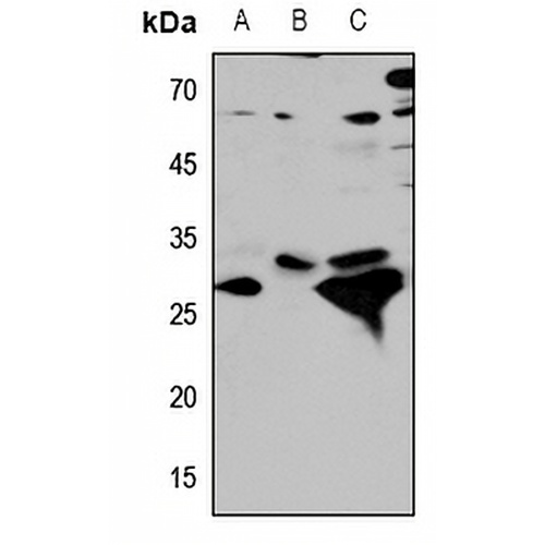 Cathepsin D Rabbit Polyclonal Antibody