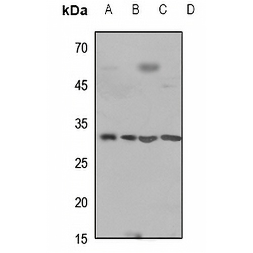 Cathepsin D HC Rabbit Polyclonal Antibody