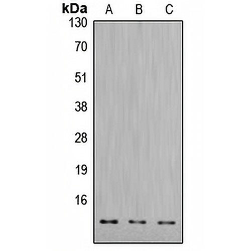 Cathepsin D LC Rabbit Polyclonal Antibody