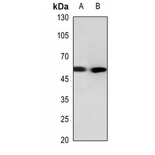 Cathepsin E Rabbit Polyclonal Antibody