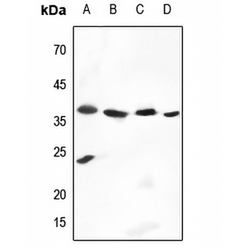 Cathepsin V Rabbit Polyclonal Antibody
