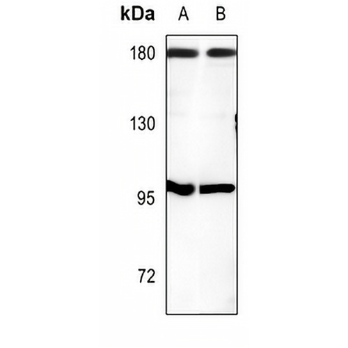 CUX1 Rabbit Polyclonal Antibody