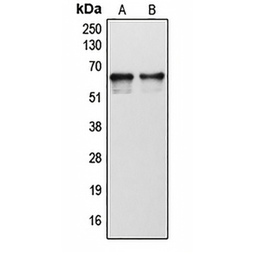 Cytochrome P450 1B1 Rabbit Polyclonal Antibody