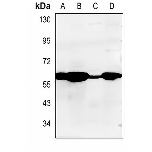 Cytochrome P450 2A13 Rabbit Polyclonal Antibody
