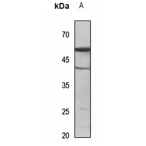 Cytochrome P450 2C9 Rabbit Polyclonal Antibody