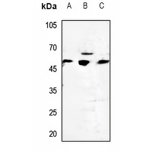 Cytochrome P450 2D6 Rabbit Polyclonal Antibody