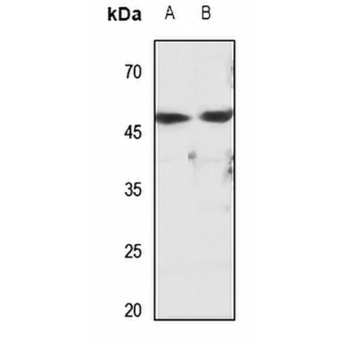 Cytochrome P450 2D6 Rabbit Polyclonal Antibody