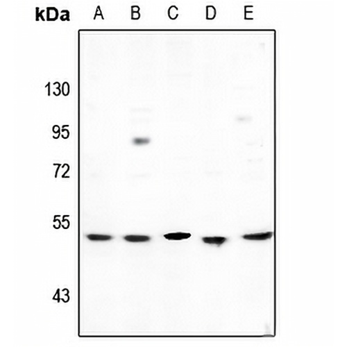 Cytochrome P450 2D6 Rabbit Polyclonal Antibody