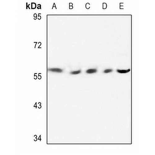 Cytochrome P450 2E1 Rabbit Polyclonal Antibody