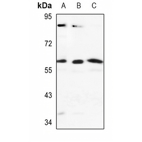 Cytochrome P450 2J2 Rabbit Polyclonal Antibody
