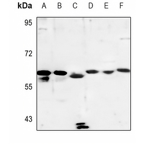 Cytochrome P450 4A11/22 Rabbit Polyclonal Antibody