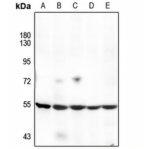 Cytochrome P450 17A1 Rabbit Polyclonal Antibody