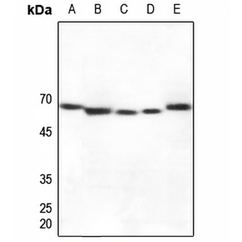 Cytochrome P450 27A1 Rabbit Polyclonal Antibody
