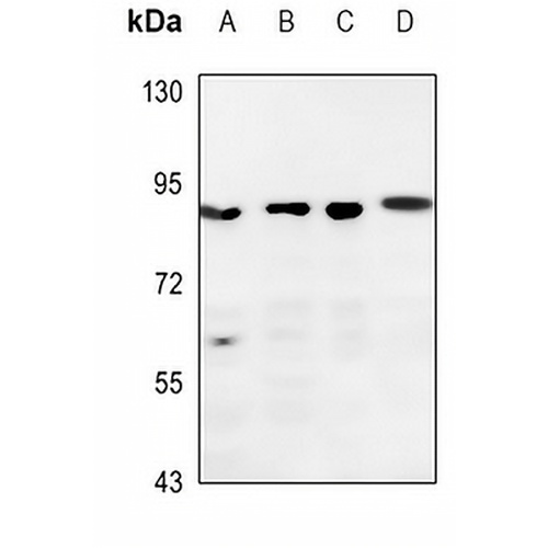 DGK beta Rabbit Polyclonal Antibody