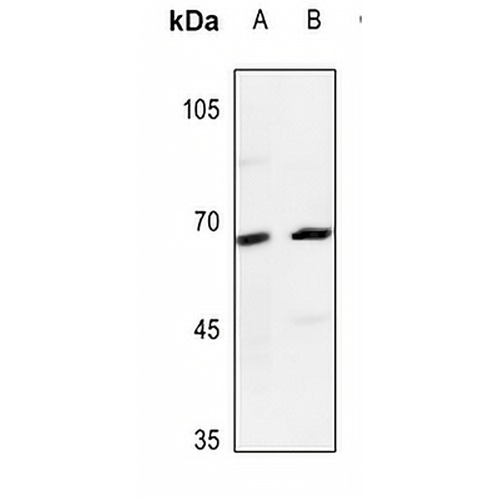Dopamine beta Hydroxylase Rabbit Polyclonal Antibody