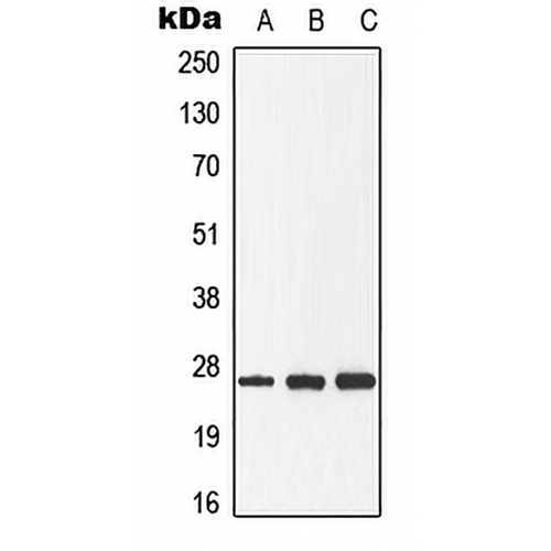 GADD153 (Phospho-S30) Rabbit Polyclonal Antibody