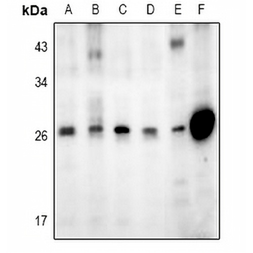 GADD153 Rabbit Polyclonal Antibody