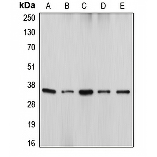 DFF45 Rabbit Polyclonal Antibody