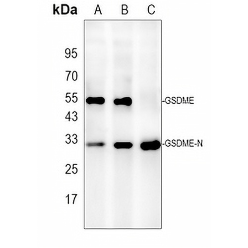 DFNA5 Rabbit Polyclonal Antibody
