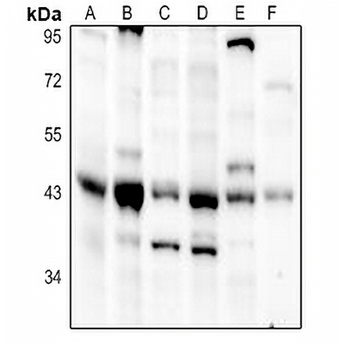 DHPS Rabbit Polyclonal Antibody