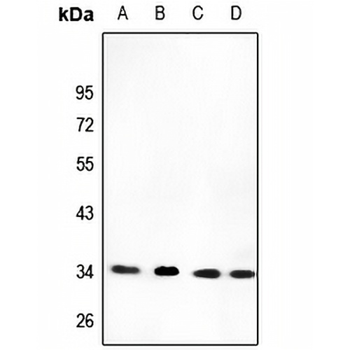 CYB5R3 Rabbit Polyclonal Antibody