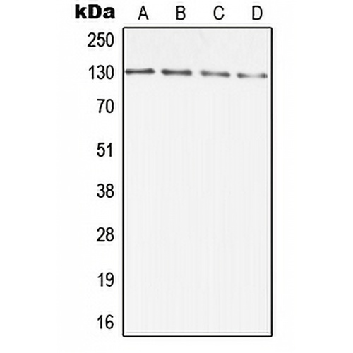 DIAPH2 Rabbit Polyclonal Antibody