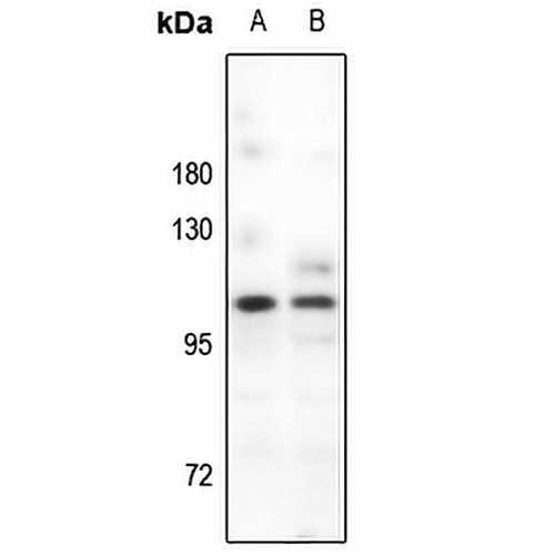 PSD93 Rabbit Polyclonal Antibody