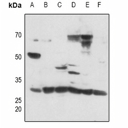 DLX5 Rabbit Polyclonal Antibody