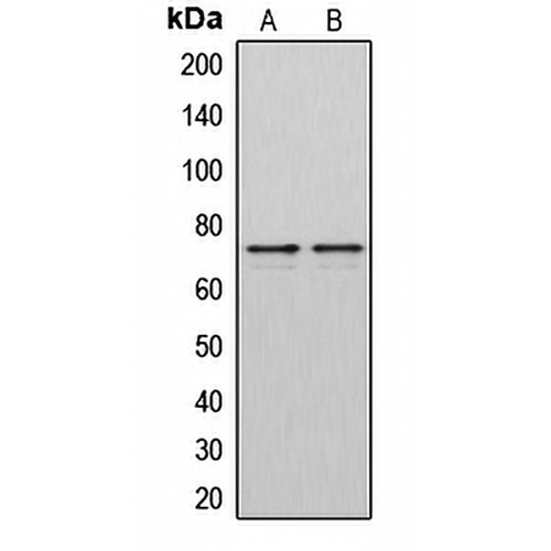 DMPK Rabbit Polyclonal Antibody