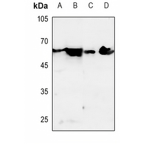 Dopamine Receptor D1 Rabbit Polyclonal Antibody