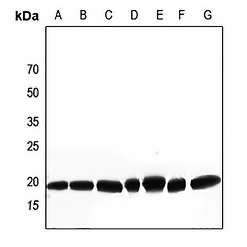 DSCR1 Rabbit Polyclonal Antibody