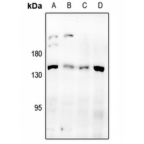 Desmoglein 3 Rabbit Polyclonal Antibody