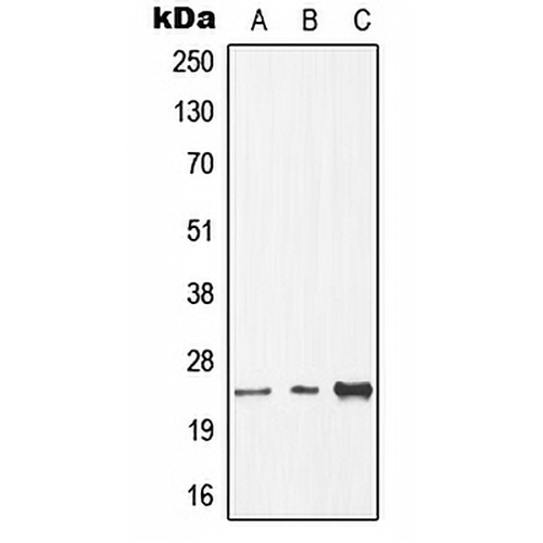 CDC8 Rabbit Polyclonal Antibody