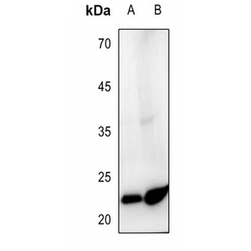 Ephrin A2 Rabbit Polyclonal Antibody