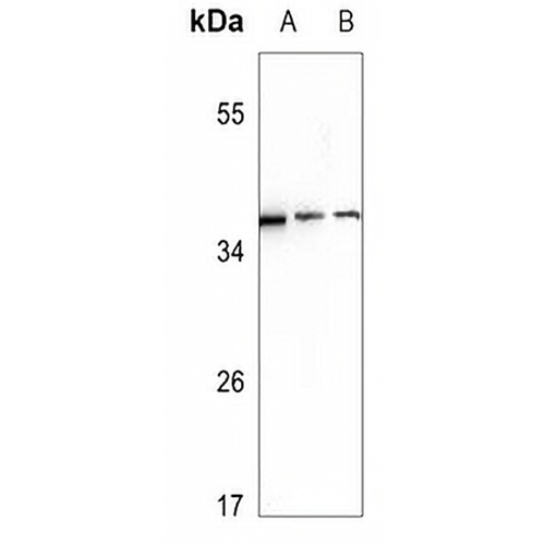 Ephrin A3 Rabbit Polyclonal Antibody